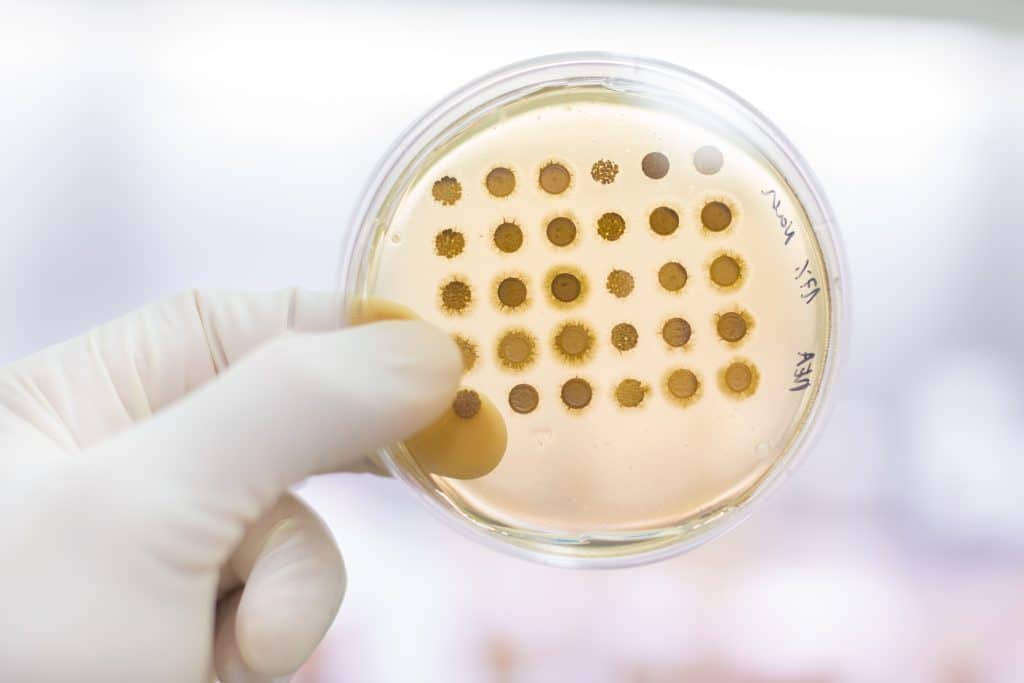 mold samples growing in petri dish